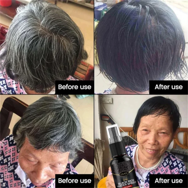 Gray White Hair Treatment Serum Cover White Hair To Black Natural Color Repair Spray Anti Loss Hair Restore Healthy Hair Care - Image 3