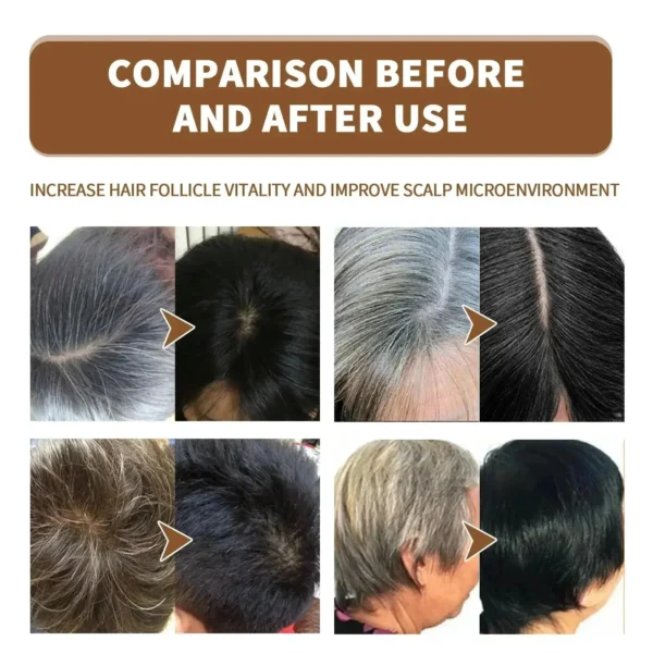 Gray White Hair Treatment Serum Cover White Hair To Black Natural Color Repair Spray Anti Loss Hair Restore Healthy Hair Care - Image 4